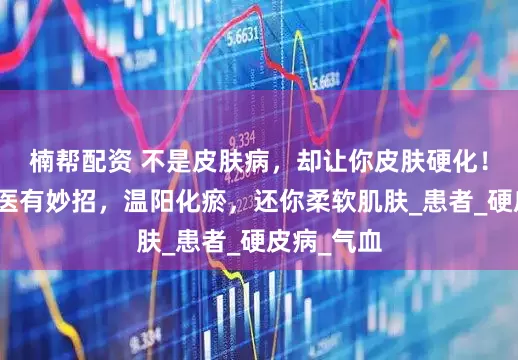 楠帮配资 不是皮肤病，却让你皮肤硬化！别慌，中医有妙招，温阳化瘀，还你柔软肌肤_患者_硬皮病_气血